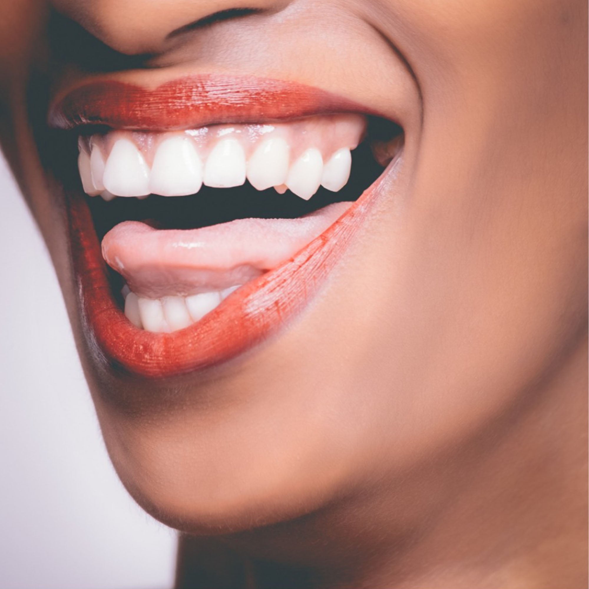 A white smile achievable with Britenz.